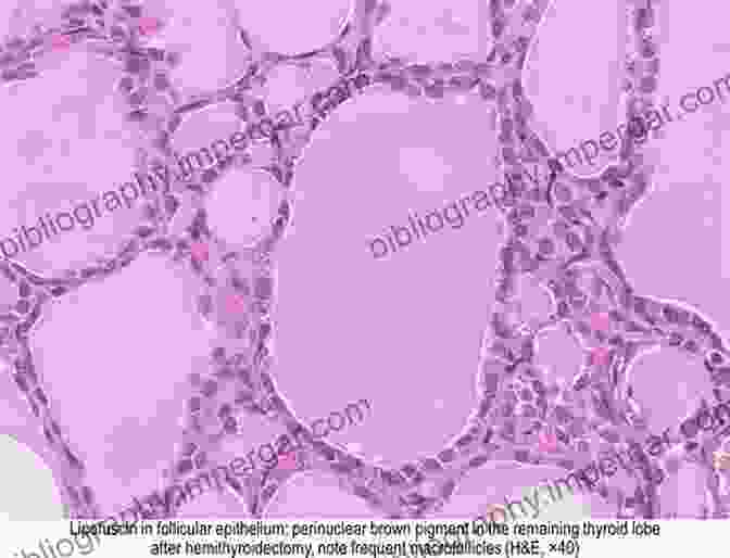 A Histological Section Of The Thyroid Gland, Showcasing Its Follicles And The Production Of Thyroid Hormones Neuroanatomy Of Neuroendocrine Systems (Masterclass In Neuroendocrinology 12)