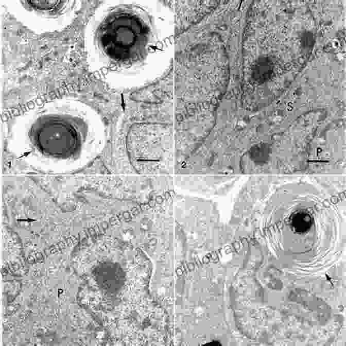 A Scanning Electron Micrograph Of The Parathyroid Glands, Highlighting Their Cellular Structure And Hormone Producing Cells Neuroanatomy Of Neuroendocrine Systems (Masterclass In Neuroendocrinology 12)