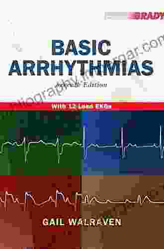 Basic Arrhythmias (2 downloads) Gail Walraven