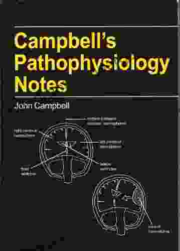 Aampbell S Pathophysiology Notes John Campbell