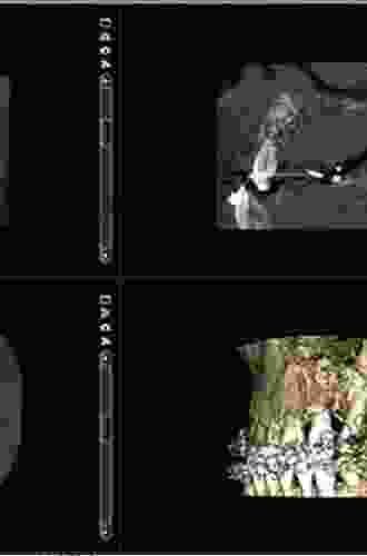 Maxillofacial Cone Beam Computed Tomography: Principles Techniques And Clinical Applications